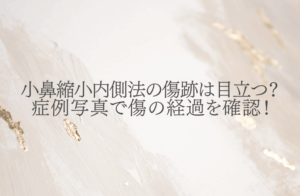 小鼻縮小内側法の傷跡は目立つ？症例写真で経過を確認